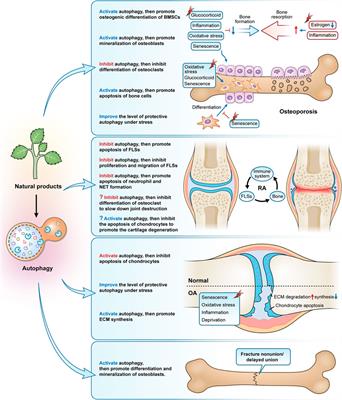 Autophagy: An important target for natural products in the treatment of bone metabolic diseases